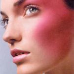 Out of the Red – Addressing Rosacea