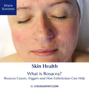 What is Rosacea? Rosacea Causes, Triggers and How Estheticians Can Help