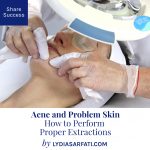 Acne & Problem Skin: How to Perform Extractions