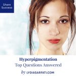 Hyperpigmentation: Top Questions Answered