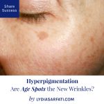 Hyperpigmentation: Are Age Spots the New Wrinkles?