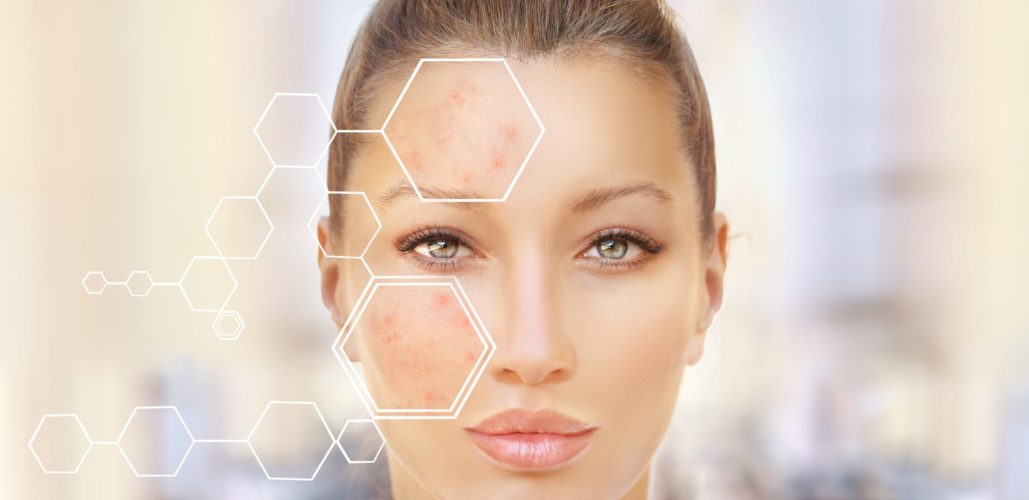 The Importance of pH in Skin Care and the Skin Barrier