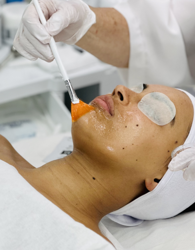 All About Peels: What Estheticians Need to Know